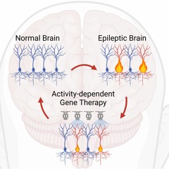 Novel ways to treat the brain with gene therapy