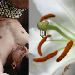 03 器官切除JZOLOFT