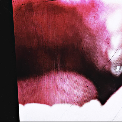 I Know Very Well How I Got My Nickname, Just Not My Face.