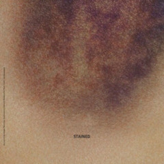 stained prod whod