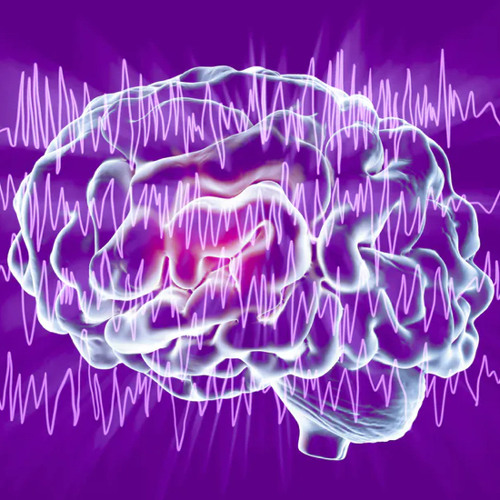 Epileptic Ant-Epileptic Wave