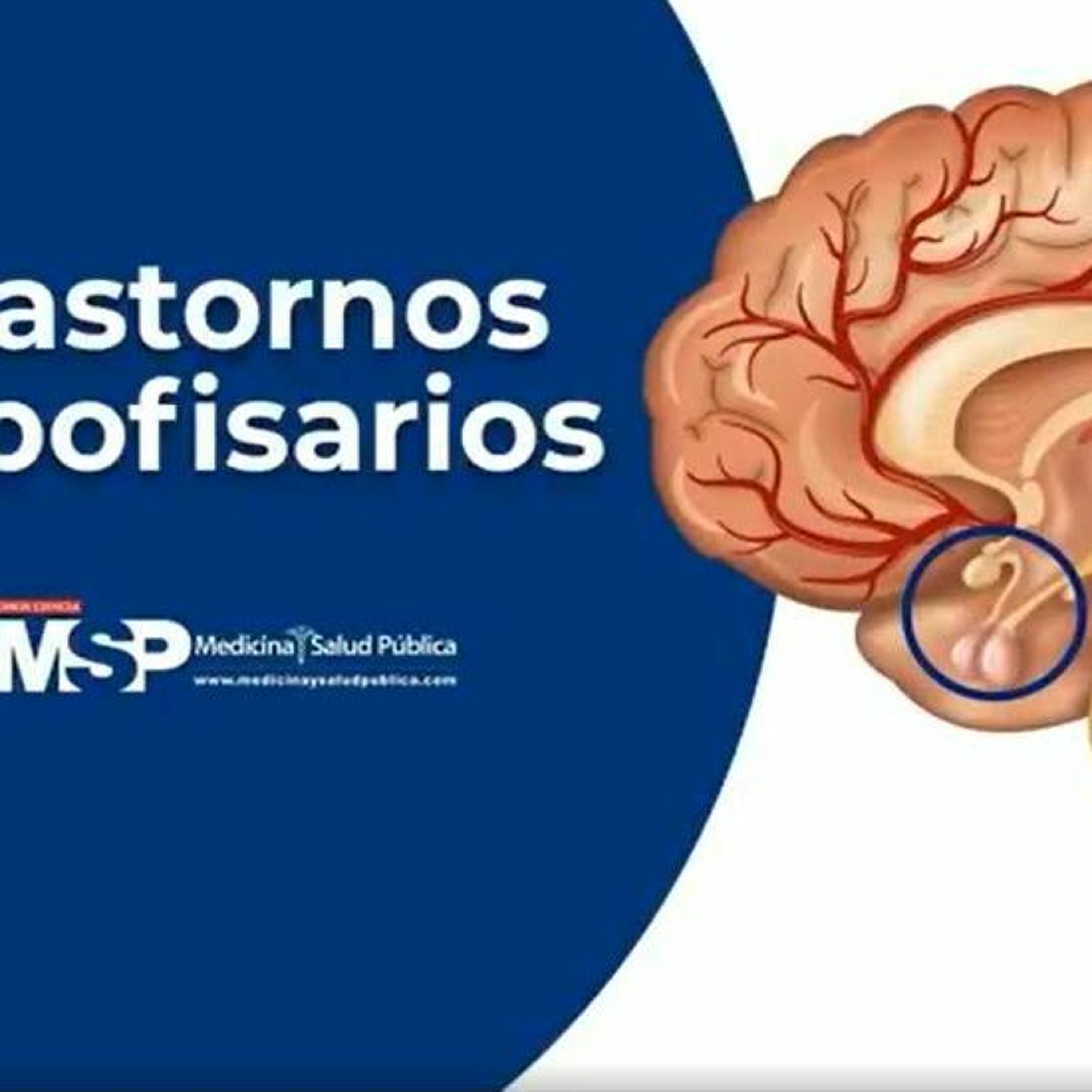 Trastornos Hipofisarios - Dr. Raúl Ibarra Salce