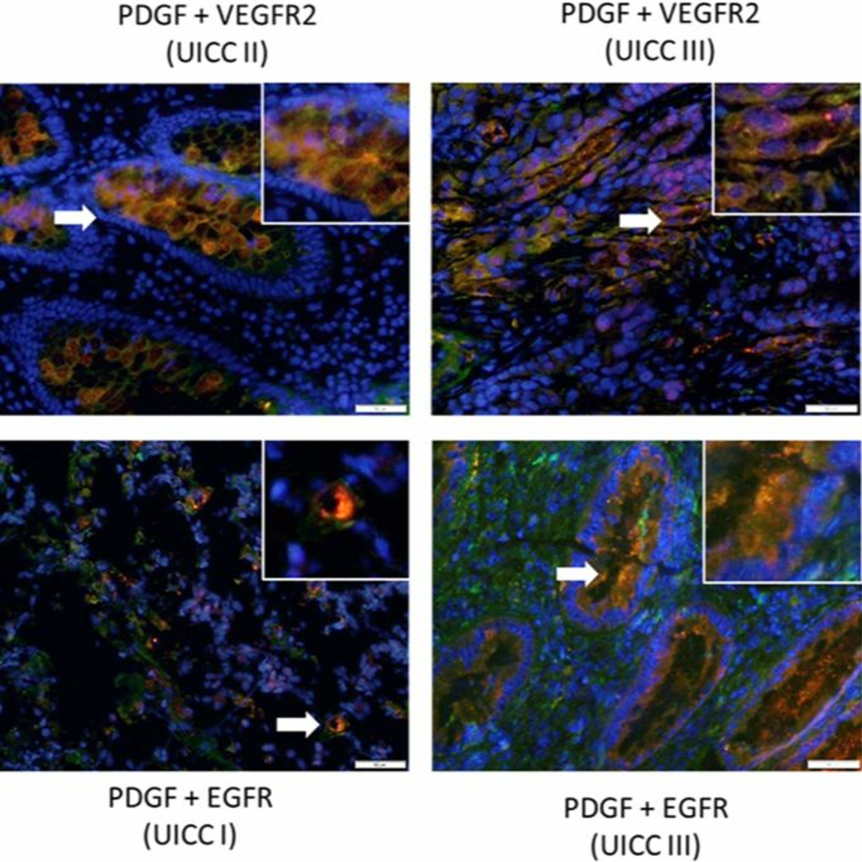 Oncotarget