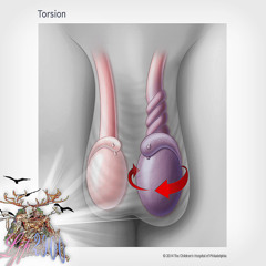 testicular torsion w/ offaflat (prod by shlain)