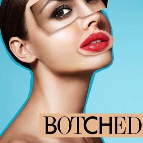 Stream episode Botched Season 8 Episode 14 FullEpisode 336517