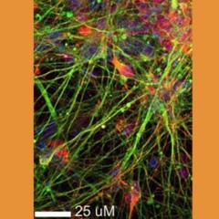 Understanding the Mechanisms of Brain Aging and Longevity in Neurons