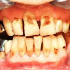 worm dirt, want sum? (acoustic)