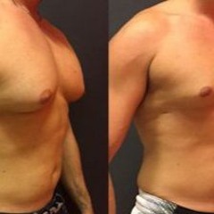 Best Estrogen Blocker For Improves Confidence And Libido! Results & Side Effects?