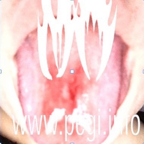 @NAONTHEWALLS MIX