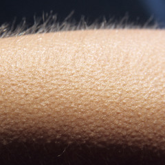 Goosebumps