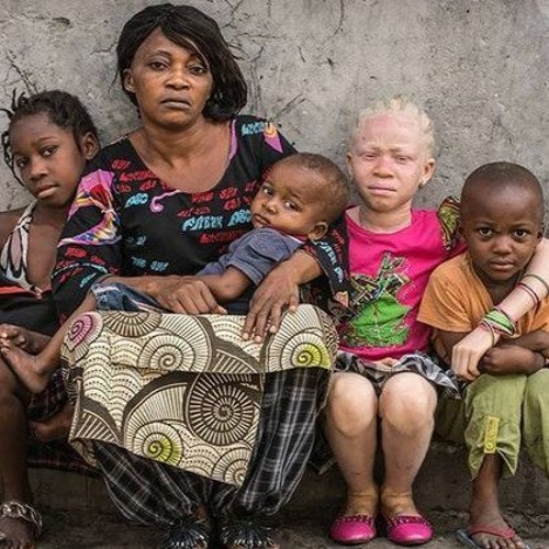 News in Brief - 24 April 2024 - Gaza, Hunger and People with Albinism