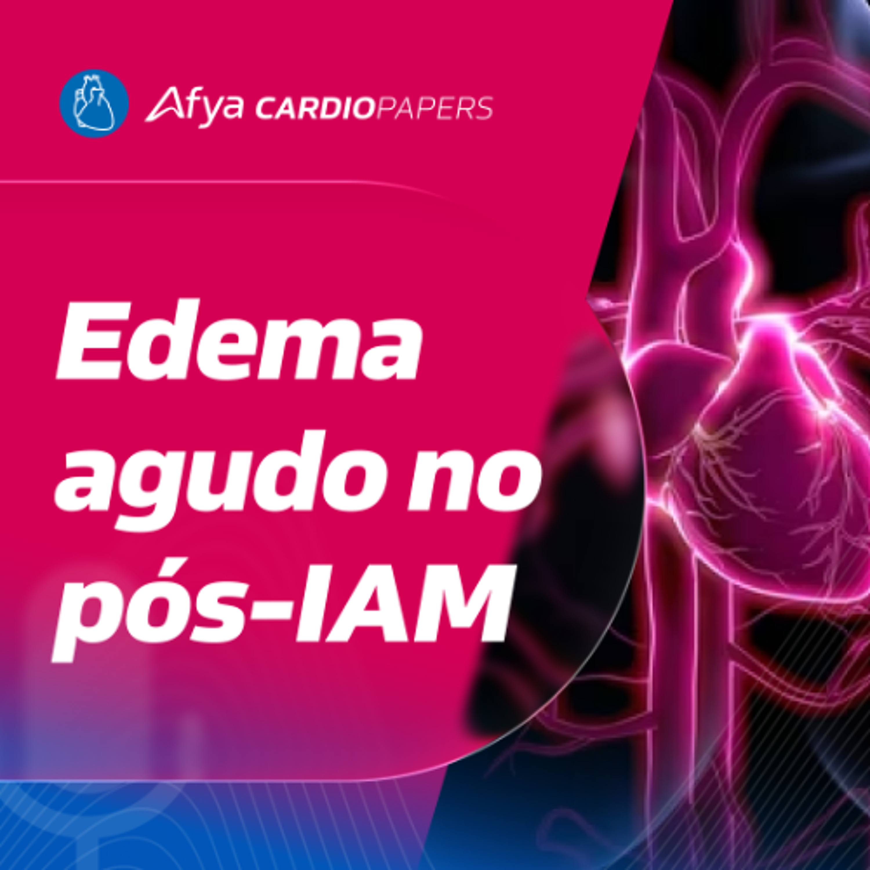 Insuficiência mitral pós-IAM: diferenciar ruptura de tethering é vital