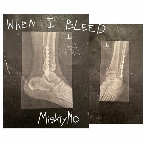 When I Bleed Prod .tetsuo *VIDEO IN DESCRIPTION*