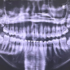 bleedlivin - locked up Prod. Bleedlivin