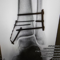 The World Left You Behind