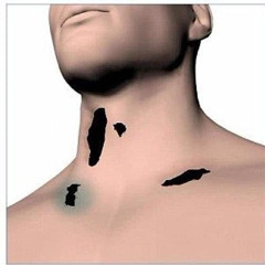 Syringe - Sulfuric Acid On My Neck (Prod. Blvc Svnd)