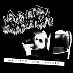 amputated and burned