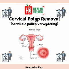 Cervical Polyp Removal (Servikale poliep verwydering)