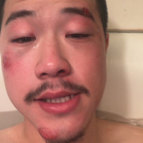 交通事故