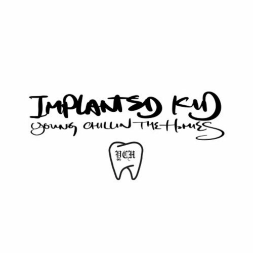 누나 내가 사랑하니까 -  Implanted Kid (임플란티드 키드)