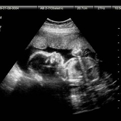 3rd Trimester Freestyle