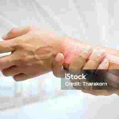 broke @propblood wrist 🤕