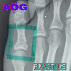 AöG MINI MIX 3ND OF 2024