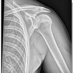 Rave all night sleep all day