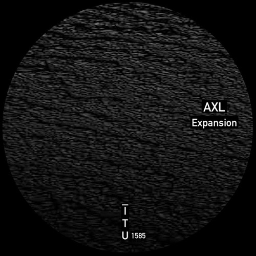 AXL - Outbreak Part Two [ITU1585]