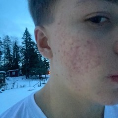 [ ккуз-ккуз ]