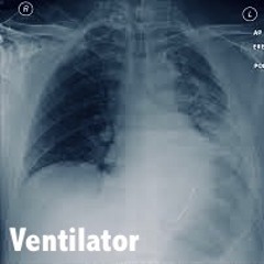 Ventilator 35 into 7
