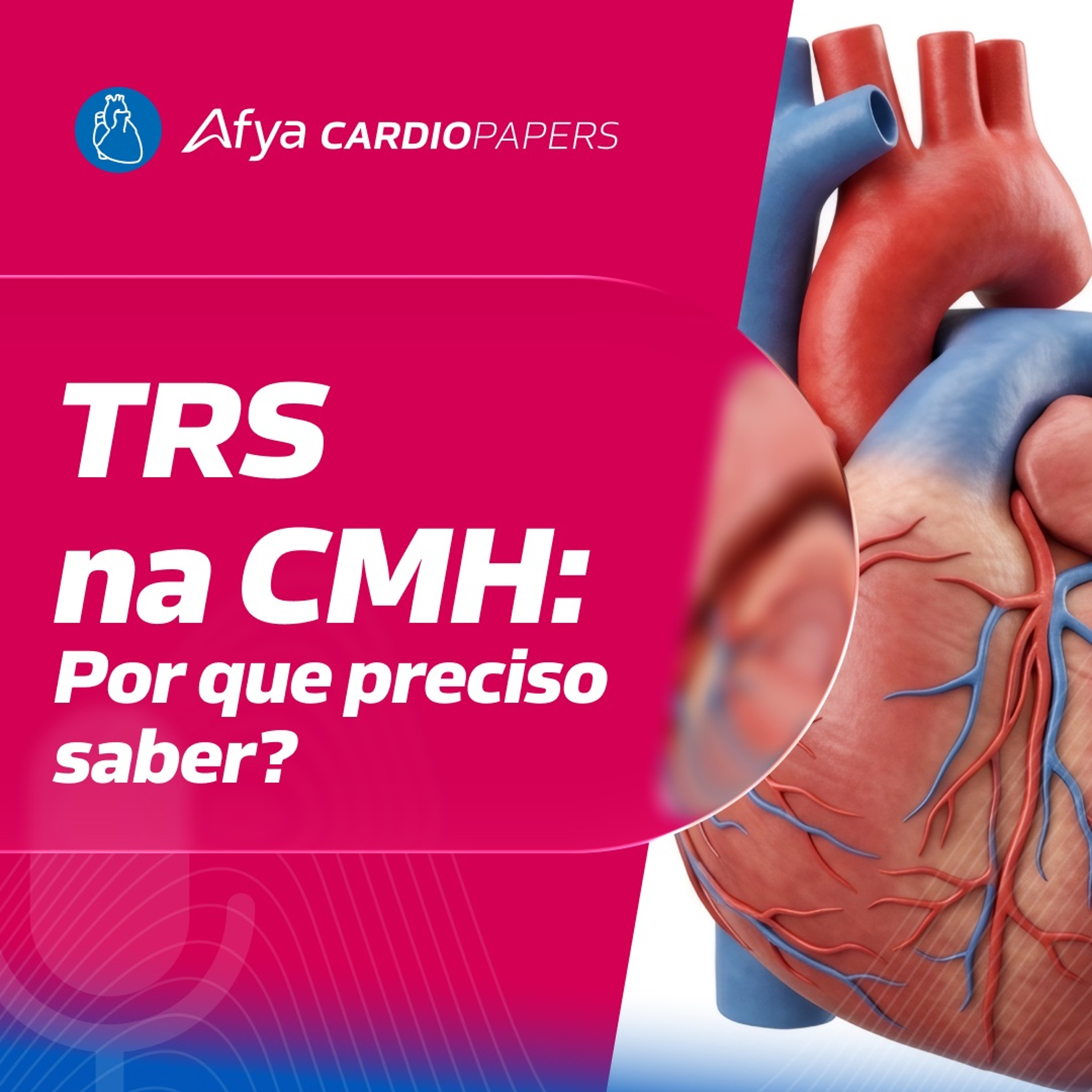 A importância da Terapia de Redução Septal na CMH episode artwork