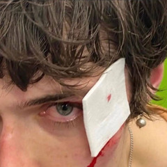 ليش متغير شجاك