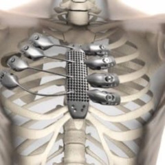 chris travis - crunch time (remix)