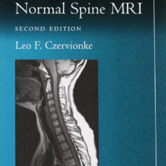 [Access] PDF 💛 Pocket Atlas of Spinal MRI (Radiology Pocket Atlas Series) by  Leo F.
