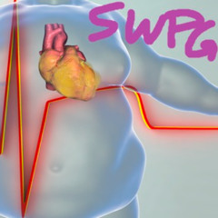 me kiero morir de un infarto