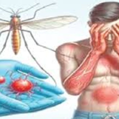 DENGUE FEVER