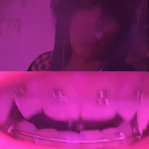 ⭐️{*BRACES*}⭐️