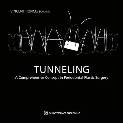 ⚡️PDF⚡️ Tunneling: A Comprehensive Concept in Periodontal Plastic Surgery