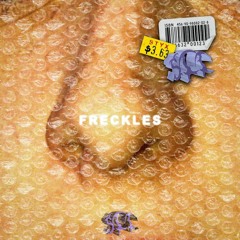 001 Freckles