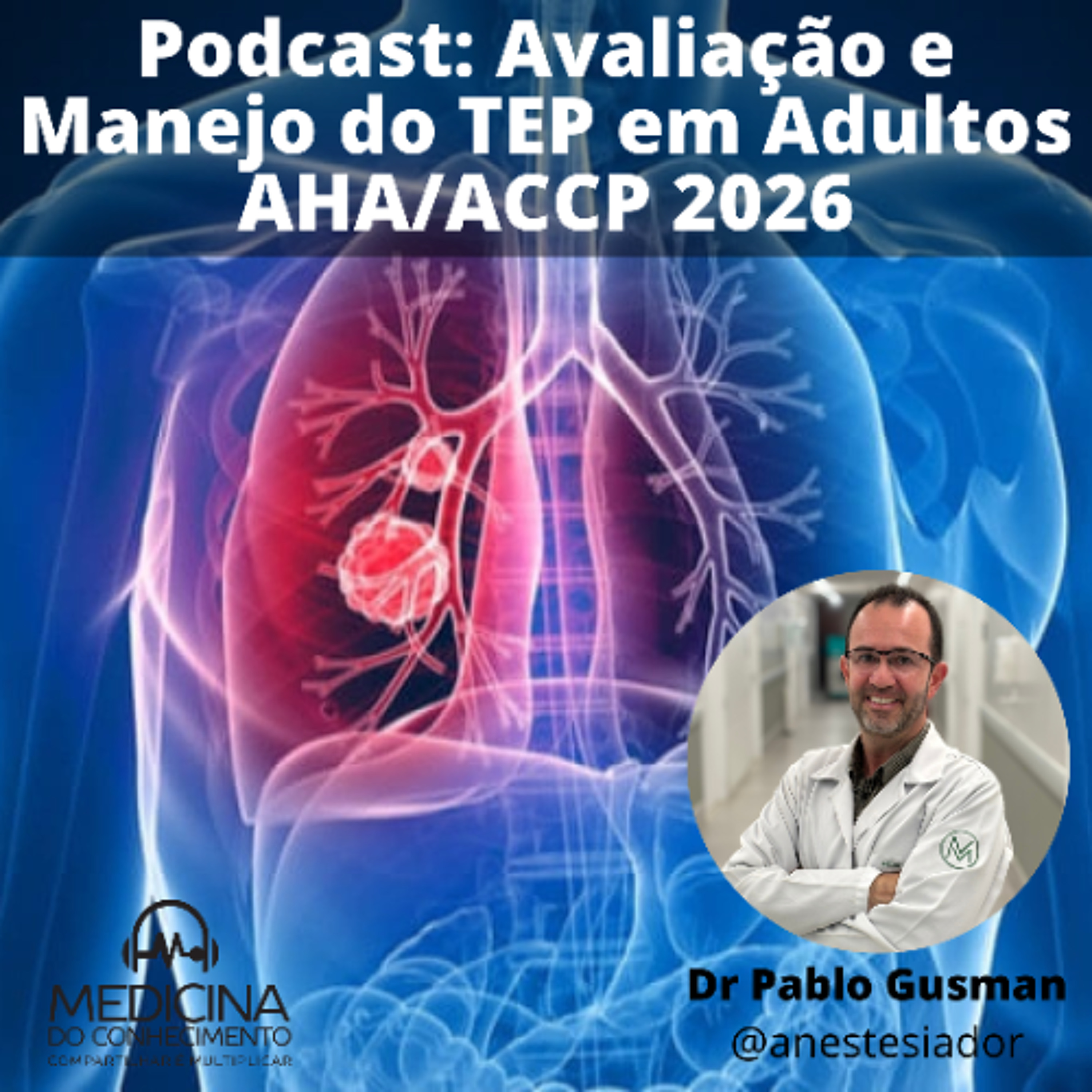 EP 177 Avaliaçao e Manejo do TEP em Adultos