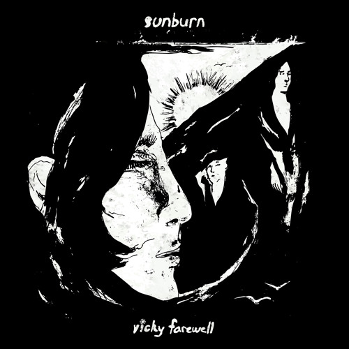 Sunburn