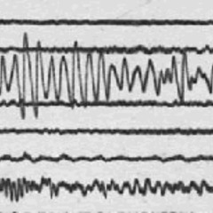 Harmonic Tremor