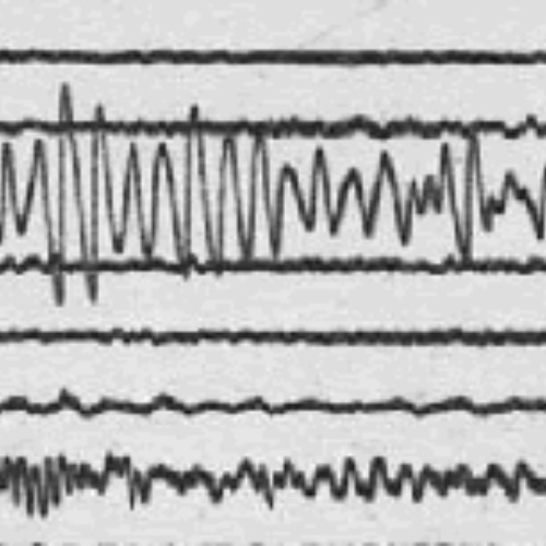 Harmonic Tremor