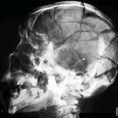 EsDeeKid - 4 Raws (INSTRUMENTAL)