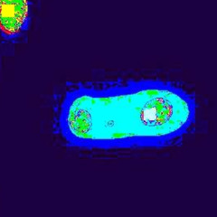 bunkermoles