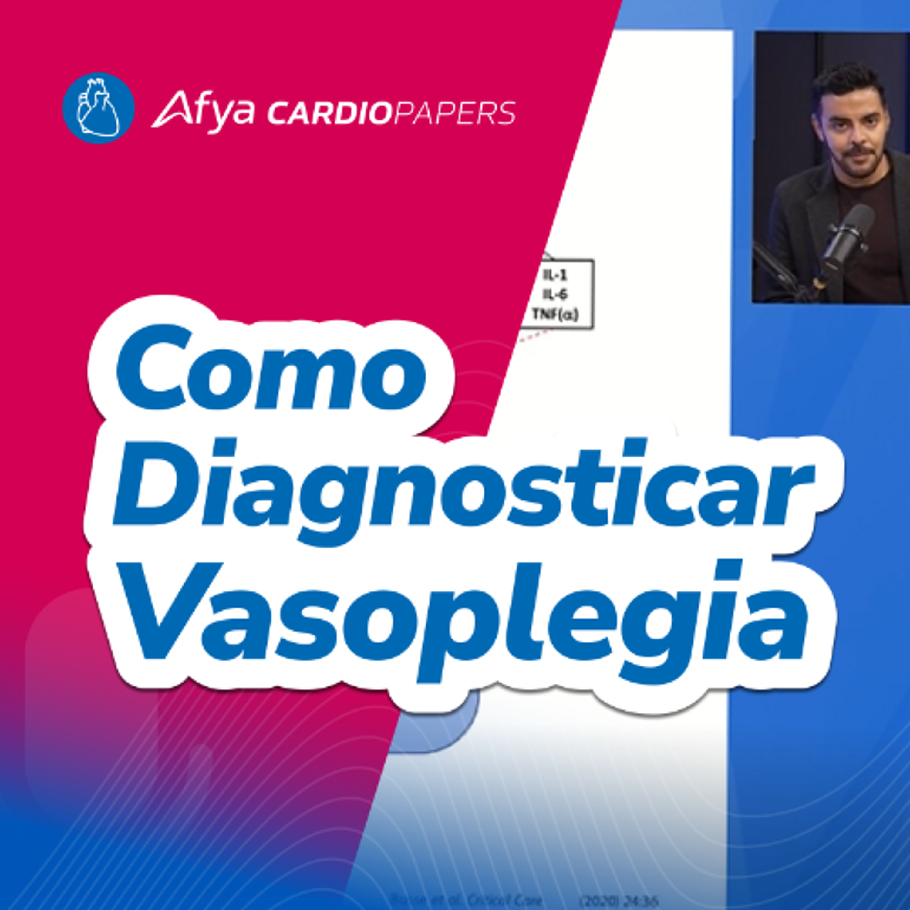 Como diagnosticar vasoplegia no pós operatório de cirurgia cardíaca?