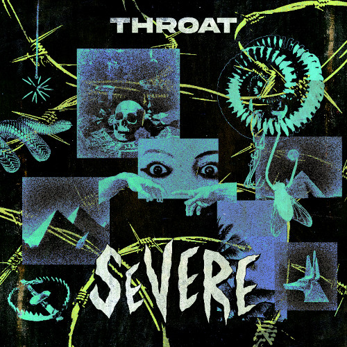 SEVERE - THROAT