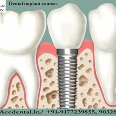 Dental implant courses in India in Affordable Prices Advanced Level At Hyderabad