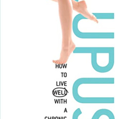READ KINDLE 💖 Despite Lupus: How to Live Well with a Chronic Illness by  Sara Gorman